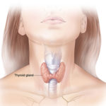 Do you have low thyroid or low progesterone?