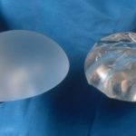 Breast implant illness: a new malady of the 21st century.